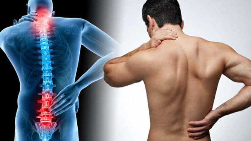 Back-Pain